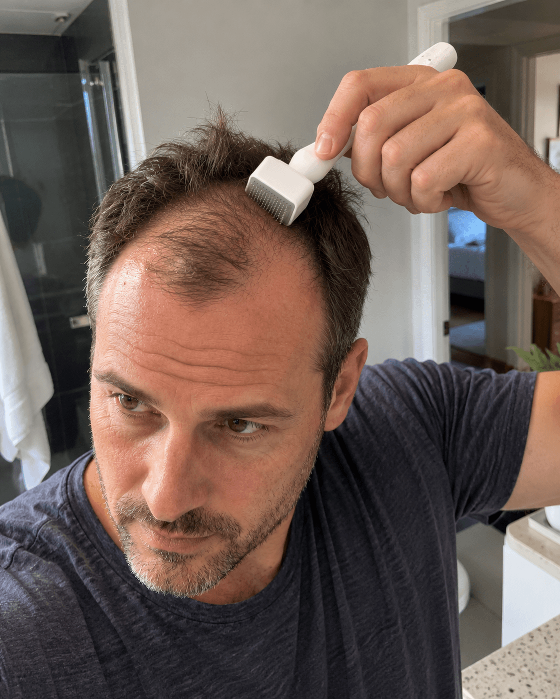 Adjustable Derma Stamp